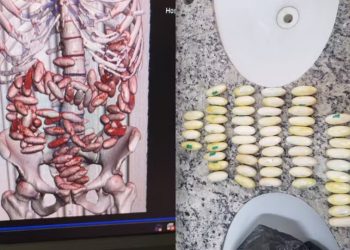 Duas pessoas são presas no Aeroporto do Recife com 214 cápsulas de cocaína no estômago