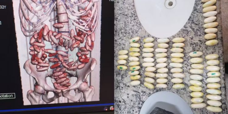 Duas pessoas são presas no Aeroporto do Recife com 214 cápsulas de cocaína no estômago