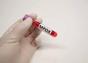 Ministério da Saúde vai instituir comitê de emergência para mpox