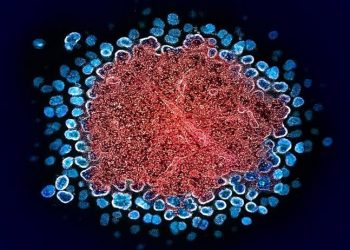 Nova Variante do HIV descoberta no Brasil