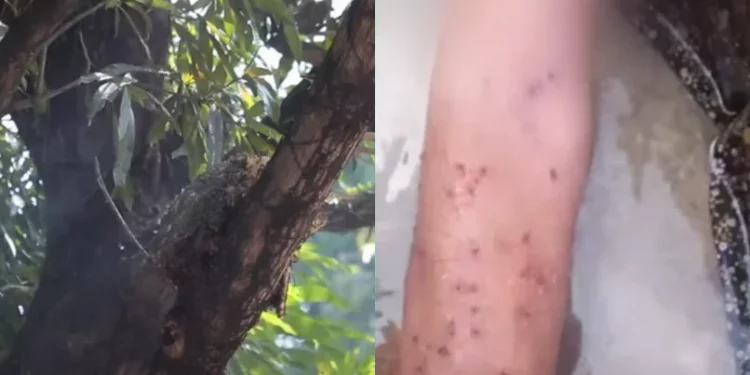 Idosa é atacada por um enxame de abelhas, em Olinda