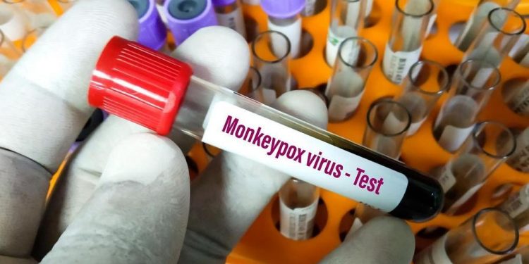 Estados Unidos confirmam primeiro caso de nova variante da mpox