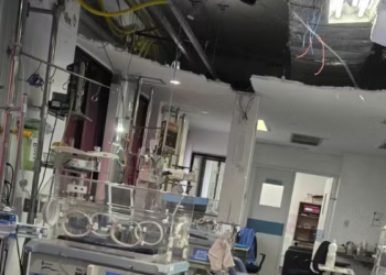 Simepe cobra providências após desabamento de forro na UTI pediátrica do Hospital Barão de Lucena