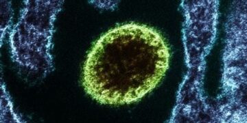 Índia confirma surto do vírus Nipah. Mais de 100 pessoas estão em quarentena