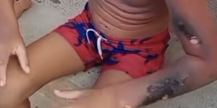 Menino de 6 anos tem corpo queimado após celular explodir