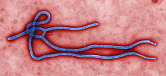 Governo descarta um dos casos suspeitos de ebola no Brasil